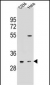 OR5L2 Antibody (N-term)